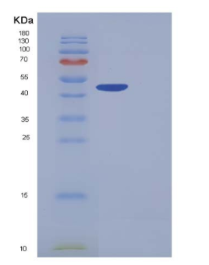 Recombinant Human Carboxypeptidase B1 / CPB1 Protein (His tag)