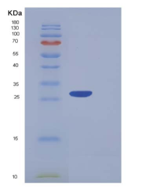 Recombinant Human PF4V1 Protein (Fc Tag)