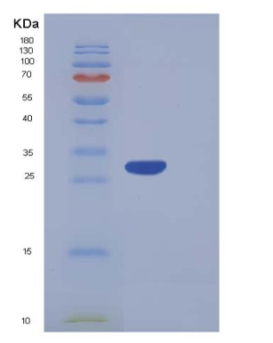 Recombinant Human CA5A / CA-VA Protein (His tag)
