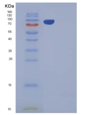 Recombinant Mouse CDCP1 Protein (Fc tag)