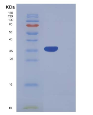 Recombinant Human PRRG2 Protein (Fc Tag)