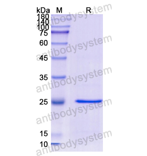 Recombinant Human GSTP1, N-His