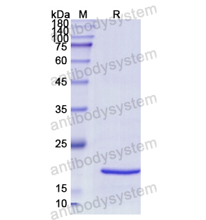Recombinant Human SNRPC, N-His