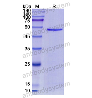 Recombinant Human MMP10, N-His