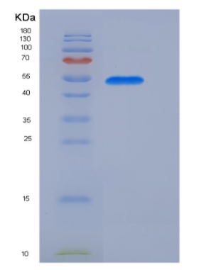 Recombinant Mouse Coagulation Factor IX / FIX / F9 Protein (His tag)