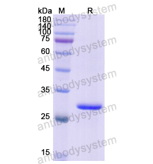 Recombinant Human QDPR, N-His