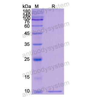 Recombinant Human RBP1, N-His