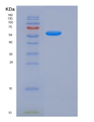 Recombinant Human PSAP / Prosaposin Protein (His Tag)