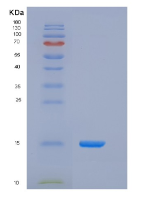 Recombinant Human CD164 / Endolyn Protein (His tag)