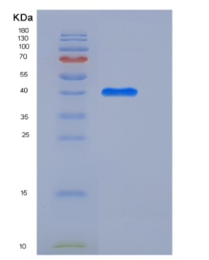 Recombinant Mouse CLEC14A / EGFR-5 Protein (His tag)
