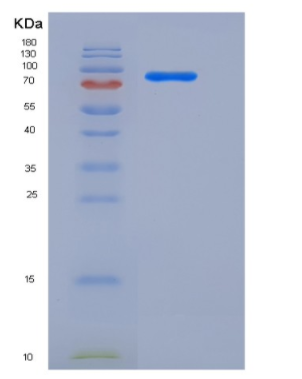 Recombinant Human AKT3 Protein (GST tag)
