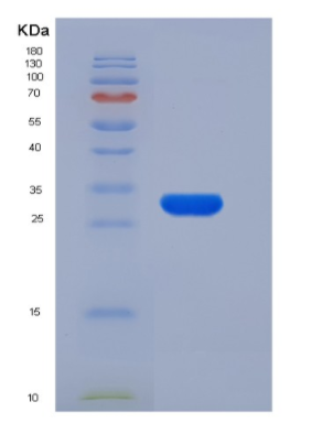 Recombinant Rat CTRB1 / Chymotrypsinogen B1 Protein (His Tag)