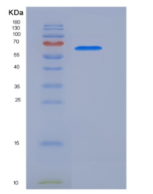 Recombinant Human CDC2 Kinase / CDK1 Protein (GST tag)
