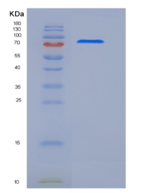 Recombinant Human MEGF10 Protein (His Tag)