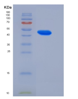 Recombinant Human GADD45A / DDIT-1 Protein (His & GST tag)