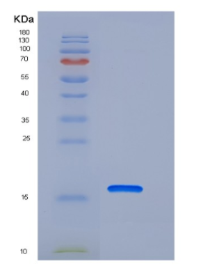 Recombinant Human PDZD11 / PDZK11 / PISP Protein (His tag)