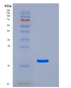 Recombinant Human CD69 Protein (His tag)