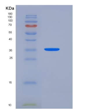 Recombinant Mouse ACP5 / TRAP Protein (His tag)