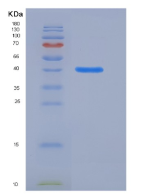 Recombinant Mouse HDAC8 / HDACL1 Protein (His tag)