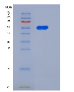 Recombinant Rat PNLIPRP1 / PLRP1 Protein (His Tag)
