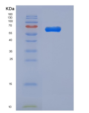 Recombinant Mouse PGRL / IGSF8 Protein (His tag)