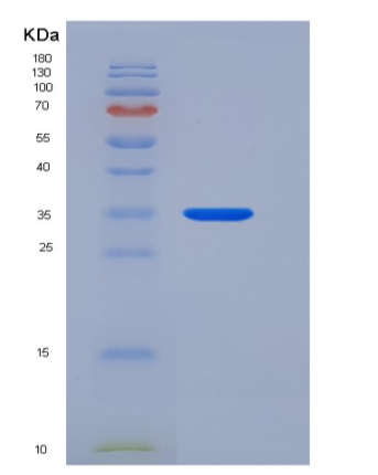 Recombinant Human ANXA5 / Annexin Ⅴ / Annexin A5 Protein