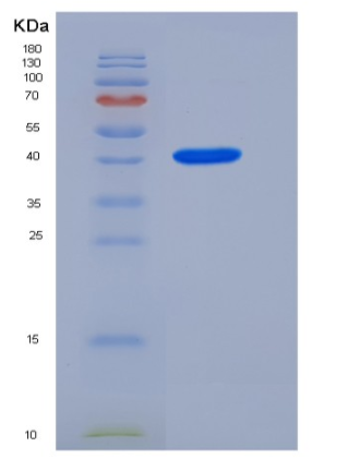 Recombinant Mouse Prostatic Acid Phosphatase / ACPP Protein (His tag)