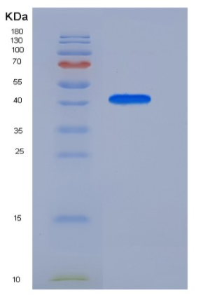 Recombinant Human APOA4 Protein (His Tag)