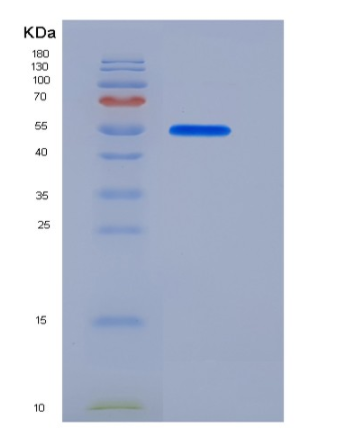 Recombinant Human PLTP Protein (His tag)