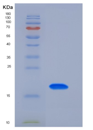Recombinant Mouse TFPI2 / PP5 Protein (His tag)