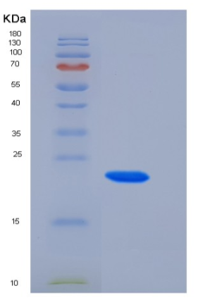 Recombinant Rat CTHRC1 Protein (His Tag)