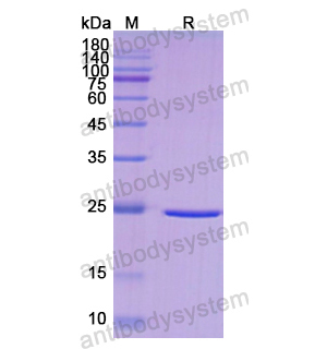 Recombinant Human DLD, N-His