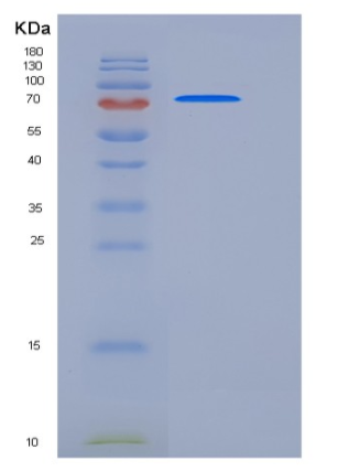 Recombinant Mouse ADAM15 / MDC15 Protein (His tag)