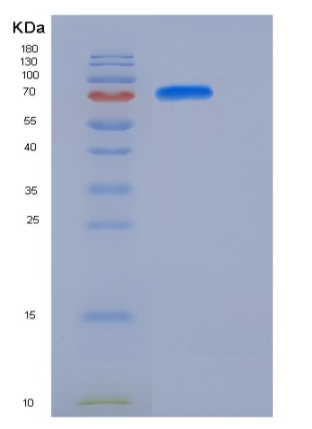 Recombinant Mouse MFI2 / CD228 / melanotransferrin Protein (His tag)