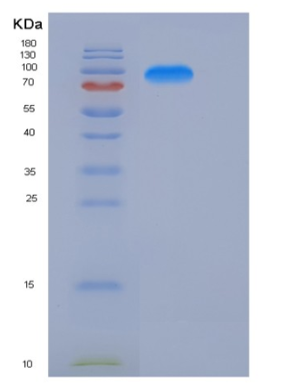 Recombinant Human KIAA1279 Protein (His & GST tag)