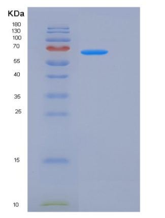 Recombinant Rat EphA3 Protein (His tag)