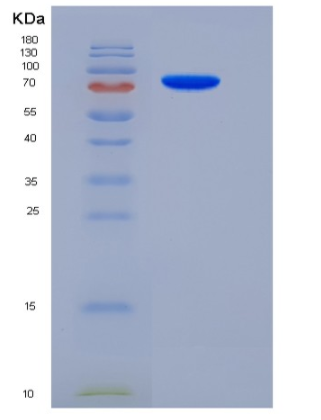 Recombinant Mouse Semaphorin 5A / SEMA5A Protein (His tag)