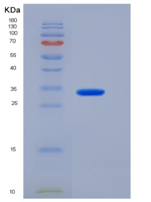 Recombinant Human IMP1 / IMPA1 Protein (His tag)