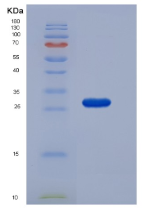 Recombinant Mouse RPE / RPE2-1 Protein (His tag)