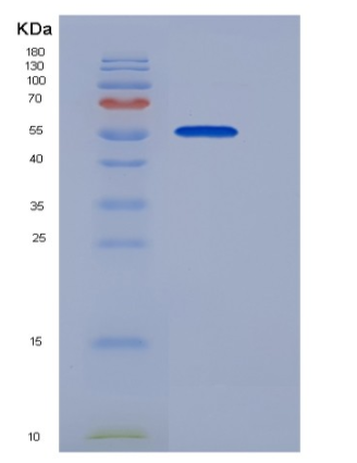 Recombinant Human S100A3 / S100E Protein (His & MBP tag)