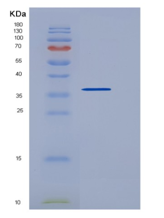 Recombinant Human TSPAN8 / Tetraspanin 8 / TM4SF3 Protein (Fc tag)