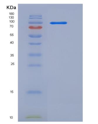 Recombinant Human Contactin 4 / CNTN4 Protein (His tag)