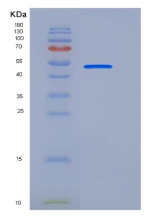 Recombinant Human CD33 / Siglec-3 Protein (Fc tag)