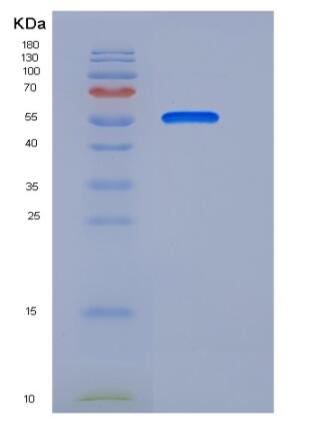 Recombinant Human TEM8 Protein (Fc Tag)