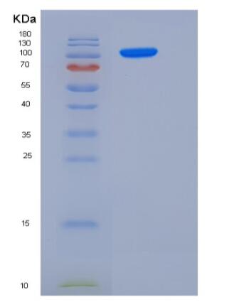 Recombinant Human Jagged 1 Protein (His Tag)