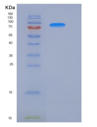 Recombinant Human ATF2 Protein (His & GST tag)