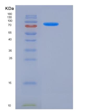 Recombinant Human PDE1B Protein (His & GST tag)