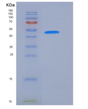 Recombinant Human VNN2 Protein (His Tag)