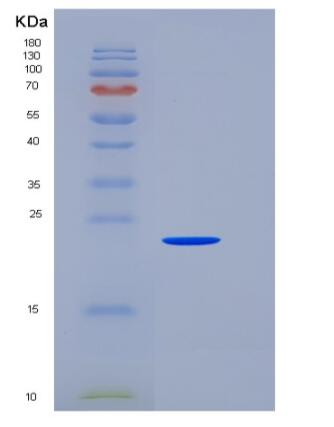 Recombinant Human SNAP25 / SUP Protein (His tag)