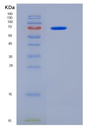 Recombinant Human MTSS1 Protein (aa1-250, His & MBP tag)
